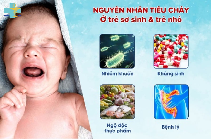 Phân sống ở trẻ sơ sinh - Cần lưu ý các dấu hiệu