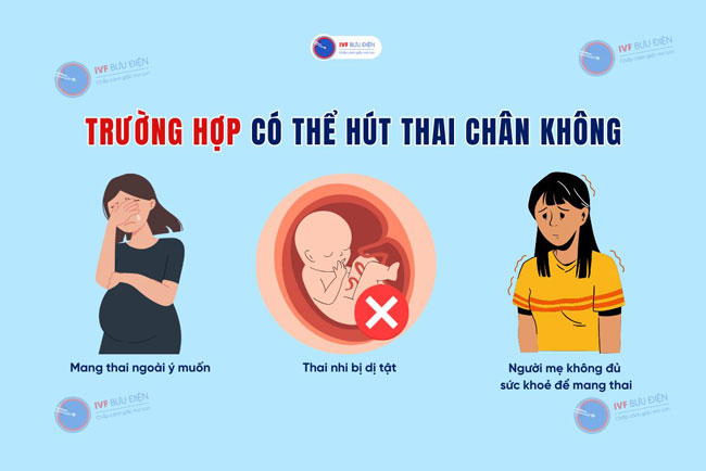 Những trường hợp được chỉ định thực hiện hút thai chân không