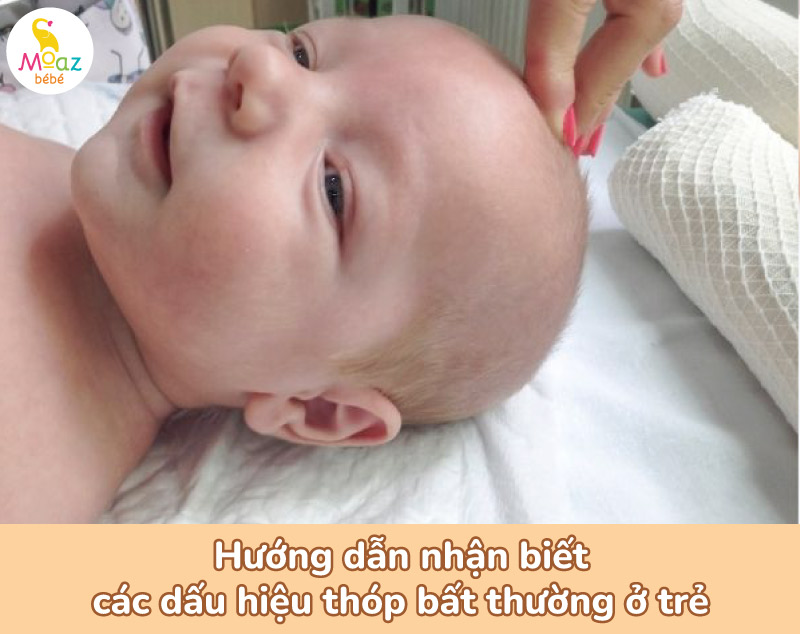 Các dấu hiệu thóp bất thường