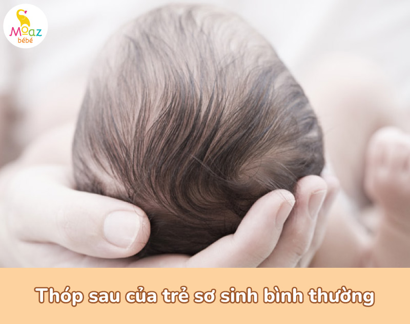 Thóp sau bình thường