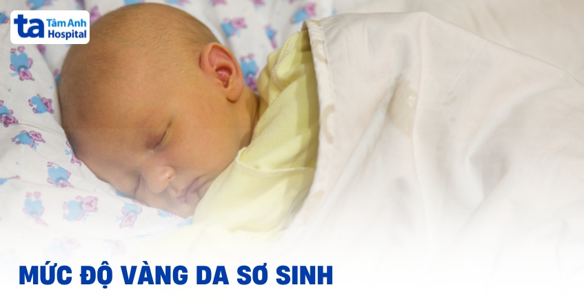 5 mức độ vàng da sơ sinh theo nồng độ Bilirubin trong máu