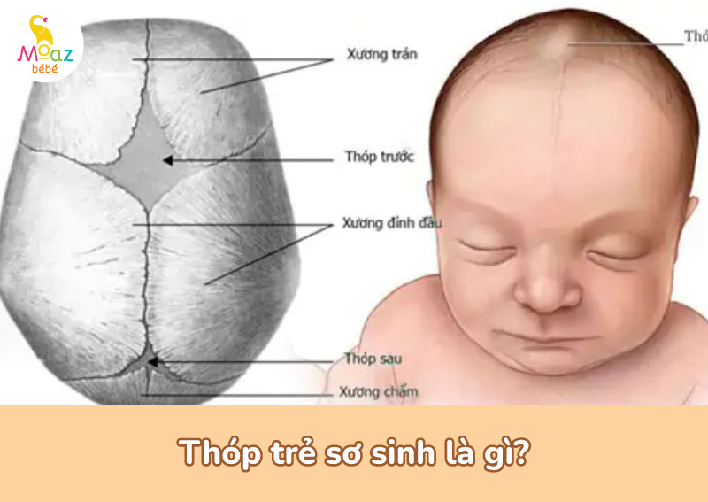 Thóp trước và thóp sau ở trẻ sơ sinh